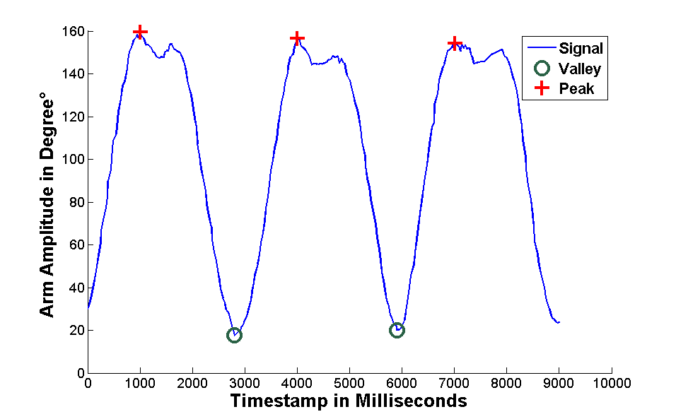 Gráficos são gerados a partir da variação de amplitude dos movimentos captados.